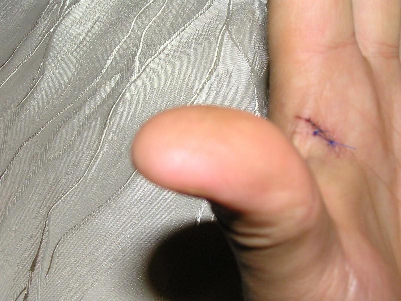post-10468-0-38978900-1446588731_thumb.jpg